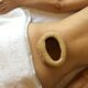 Basti en Ayurveda para enfermedades crónicas: qué es, para qué sirve y en qué casos se utiliza